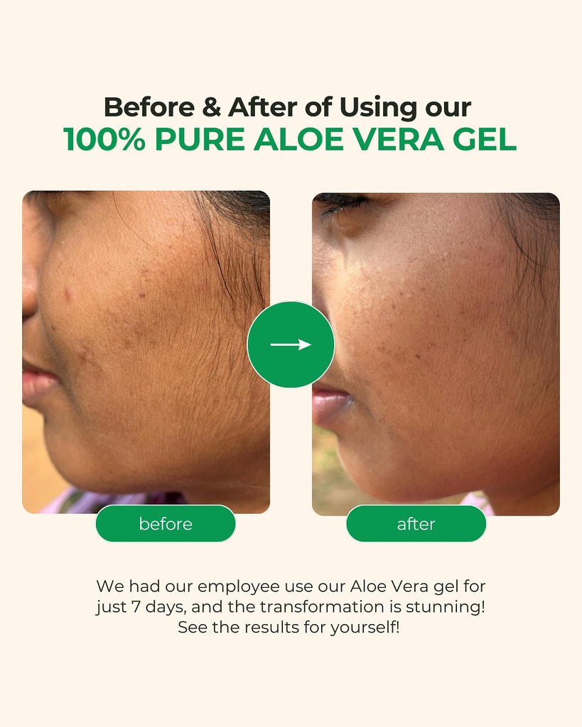 Organic Aloe Vera Gel